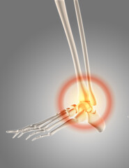 3D render of a skeleton with ankle highlighted to show pain