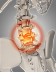 3D render of a skeleton with spine highlighted showing pain