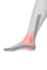 Therapeutic tape on female foot isolated on white background. Chronic pain, alternative medicine. Rehabilitation and physiotherapy.