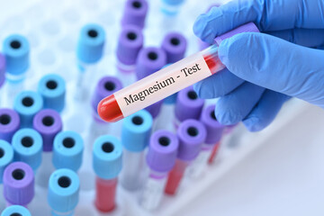 Obraz premium Doctor holding a test blood sample tube with Magnesium test on the background of medical test tubes with analyzes