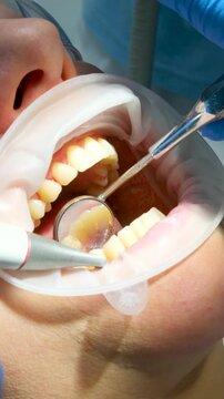close-up woman dentistry brushing teeth cleaning removing plaque stones saliva ejector using oral mirrors newest technology sandblaster goggles water drops spilling 