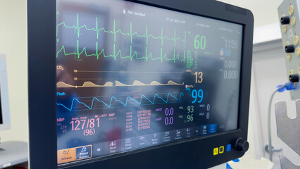 Medical vital signs monitor displaying critical health metrics - blood pressure, pulse,...
