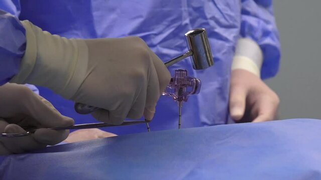 Spine Vertebroplasty Procedure in the hospital
