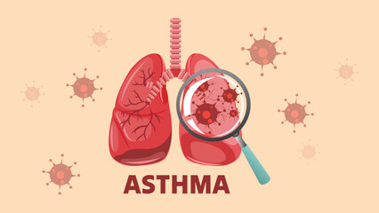Asthma Patient Infected Lungs Analysis Using Magnifying Lens Illustration with Set of Icons of Viruses and Bacteria