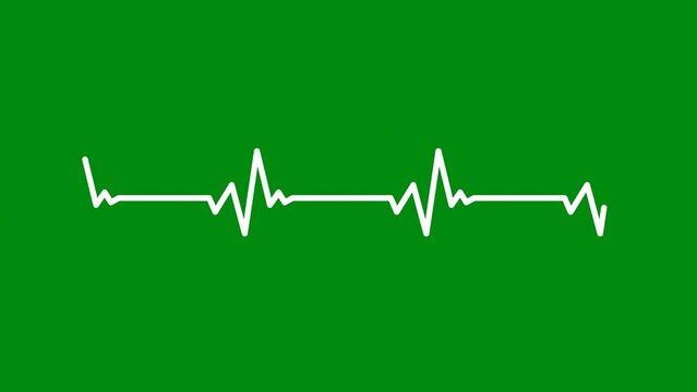 Heartbeat Pulse Rate animation Green Screen. Electrocardiogram beeping trace in Heart rate monitor. Blood pressure Pulse trace. Heart rhythm EKG or ECG. Monitoring Patient Health Condition.
