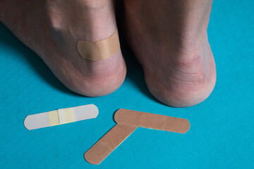 Grated calluses on women's heels, pasted leuco plaster