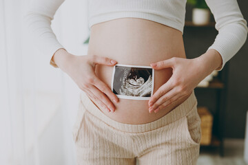 Cropped young pregnant woman in casual clothes stand near window hold in and ultrasound picture...