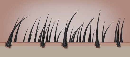 Dried and damaged hair follicles - 3D illustration