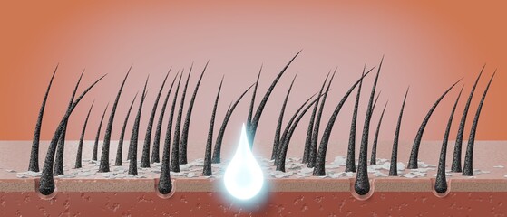 Hair follicles and shampoo treatment against dandruff - 3D illustration
