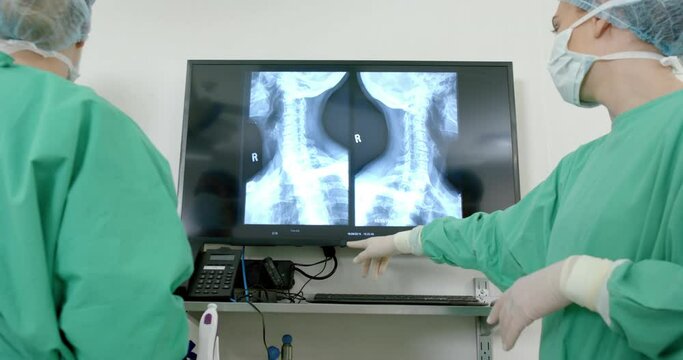 Diverse surgeons wearing surgical gowns looking at x-ray scans in operating theatre, slow motion
