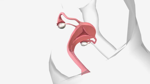 cervix is a small canal that connects your uterus and vagina