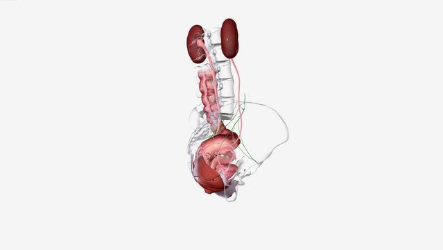 Cervical Cancer Stage 4 means the cancer has spread to the bladder or back passage (rectum) or further away