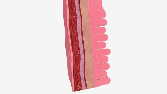 Stage 0 means that there are severely abnormal cells in the inner lining of the oesophagus