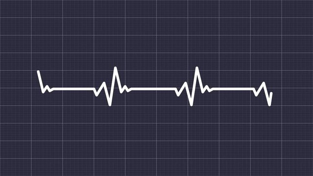 Heartbeat Pulse Rate animation with grid Background. Electrocardiogram beeping trace in Heart rate monitor. Blood pressure Pulse trace. Heart rhythm EKG or ECG. Monitoring Patient Health Condition.