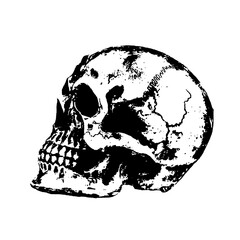 side view of the skull