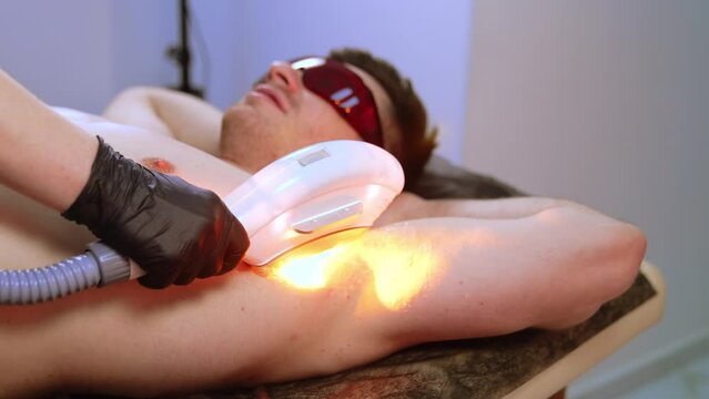 Armpit zone hair removal in salon. Cosmetologist applies Elos laser device to get rid of hair on male skin.