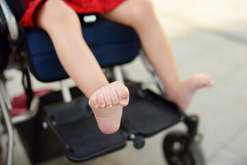 Disabled girl sitting in wheelchair. Close up photo of her legs spasticity muscles . Child cerebral palsy. Disability. Inclusion.