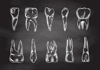 Stomatology hand drawn set. Toothache treatment. Teeth sketch.  Different types of human tooth.  Engraving fangs and molars isolated on chalkboard background.
