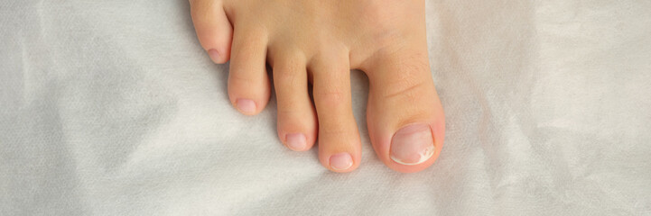 Female foot with pedicure, cosmetic treatment of feet and toenails
