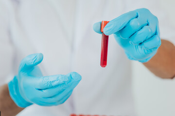 Close up of male doctor taking blood sample tube from rack with analyzer in lab / Technician holding blood test tube in research lab