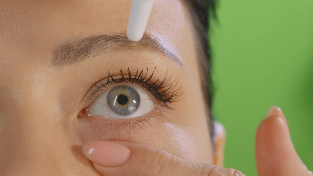 Close up view of female eye, girl shows using of eye drops, chromakey green background. Unrecognized model with blue eyes, curing some disease, dry eyes problem, symptom of illness. HQ 4k footage
