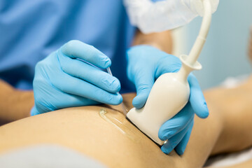 A close-up of a male physical therapist performing dry needling therapy on a man to relieve pain...