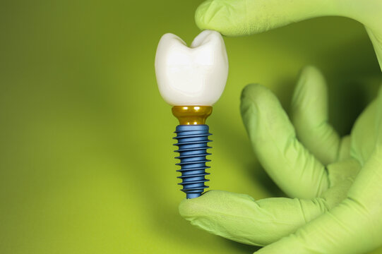 implant on green background ,