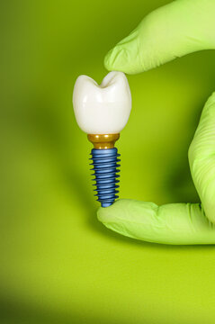 implant on green background ,