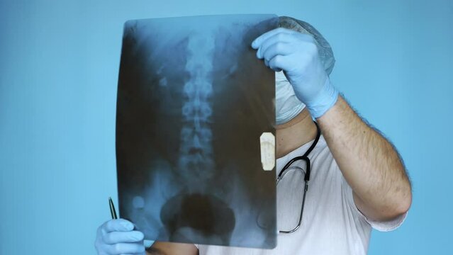 The doctor diagnoses the spine, in the hands with an x-ray of the human spine. Diagnosis and therapy of osteochondrosis, diseases of the spine. Doctor in hospital makes a diagnosis of back disease.