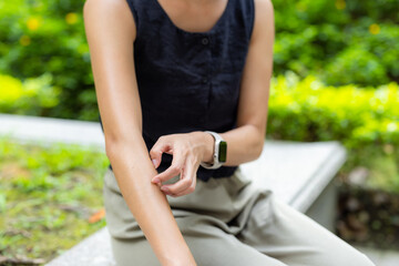 Woman feeling itchy of mosquito bite in the countryside park