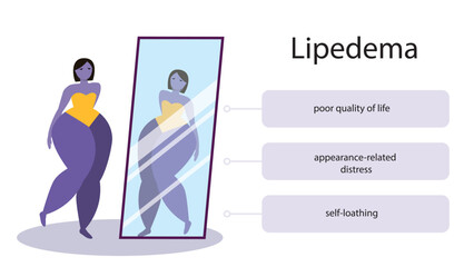 Sad woman suffering with lipedema disease looking at a mirror. Obese woman 