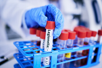 Scientist, hand and bacteria sample in test tube, person in lab with medical research and...