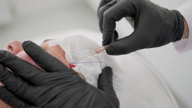 Cosmetic procedures for face lifting with a thread