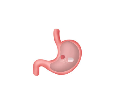 Stomach Intestine is Being Treated With Medicine Pill, Capsule with medicament, Dissolving drug, Human Stomach treatment, Capsule with medicaments, gastritis vaccine in a pill concept, transparent PNG