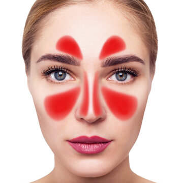 Face with inflammation of mucous membrane of paranasal sinuses.