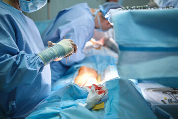 Professional doctor operating a patient conducting open heart surgery in surgical room. Healthcare...