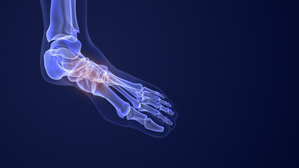 Pain from aching feet and fallen arches