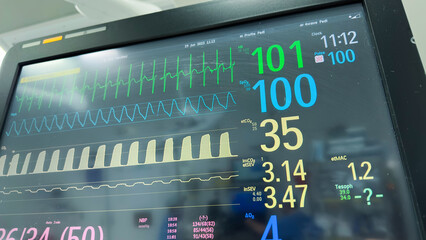 Hospital monitor displaying vital signs: heart rate, blood pressure, pulse oximetry, temperature. Symbolizing health monitoring and medical care - obrazy, fototapety, plakaty