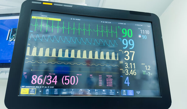 Hospital monitor displaying vital signs: heart rate, blood pressure, pulse oximetry, temperature. Symbolizing health monitoring and medical care