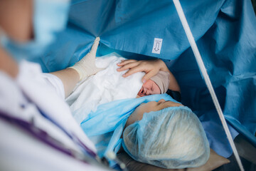 First sight of mom and her newborn in operation room