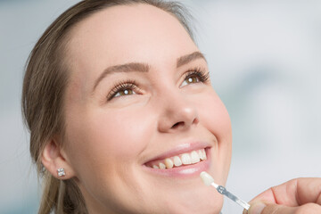 Close up of dentist using shade guide at woman's mouth to check veneer of teeth for bleaching
