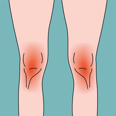 Sore knees. Medical background. Vector flat illustration