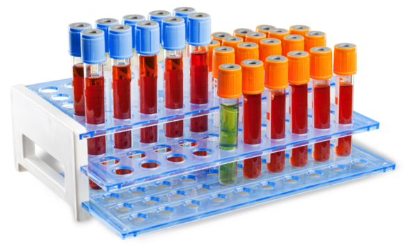 Analysis lab sample of new strain of Coronavirus Omicron.