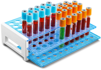 Analysis lab sample of new strain of Coronavirus Omicron.