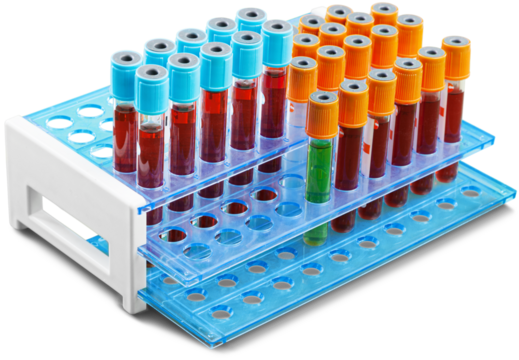 Analysis lab sample of new strain of Coronavirus Omicron.