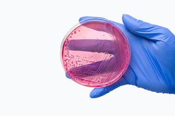 gloved hand holds petri dish with Escherichia coli colonies on MacConkey agar