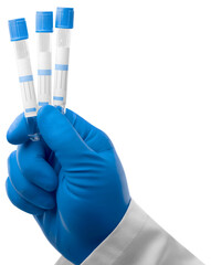 Researcher hold blood sample for New Variant of the Covid-19. Doctor in analysis lab