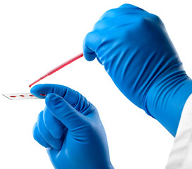Lab scientist a rapid diagnostic test to detect presence of viral protein expressed by  virus disease, fast point of care testing - obrazy, fototapety, plakaty