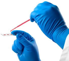 Lab scientist a rapid diagnostic test to detect presence of viral protein expressed by  virus disease, fast point of care testing