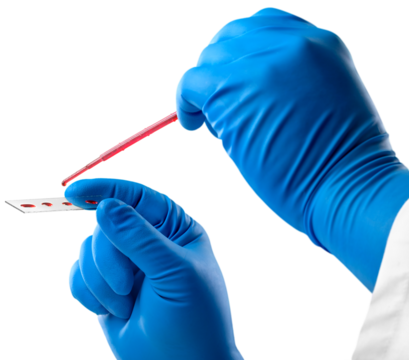 Lab scientist a rapid diagnostic test to detect presence of viral protein expressed by  virus disease, fast point of care testing